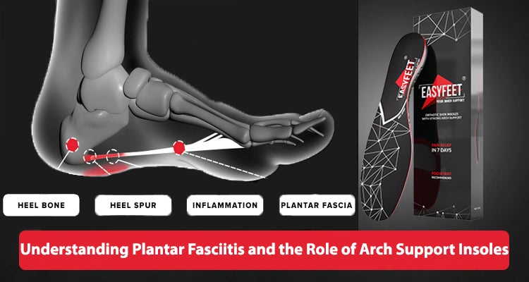 Understanding Plantar Fasciitis and the Role of Arch Support Insoles