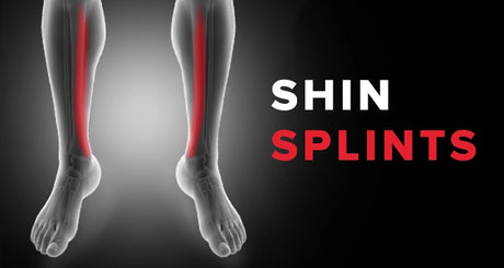 Benefits of Orthotics for Shin Splints
