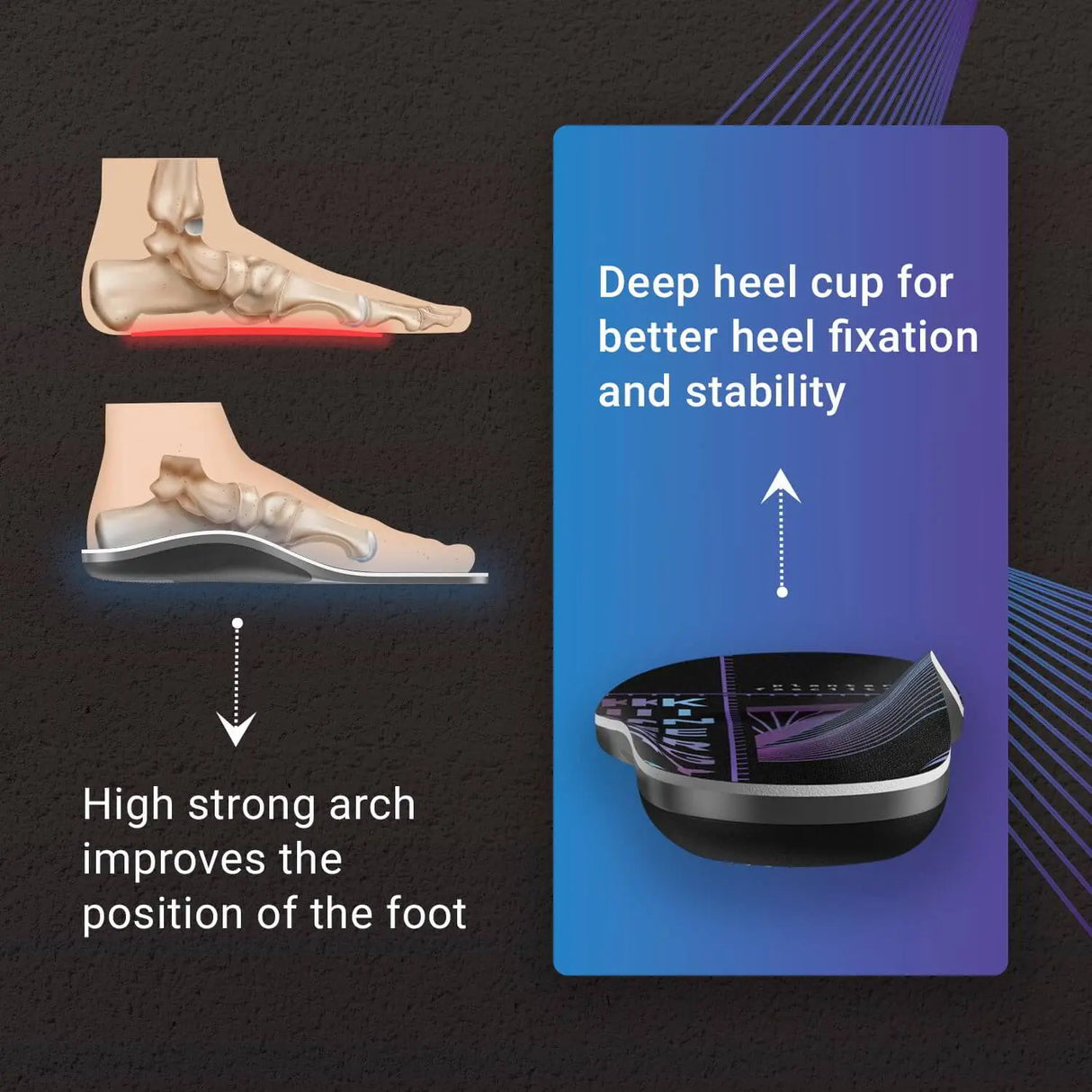 Plantar Fasciitis Kinergy