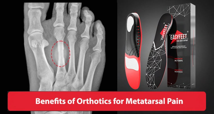 Benefits of Orthotics for Metatarsal Pain